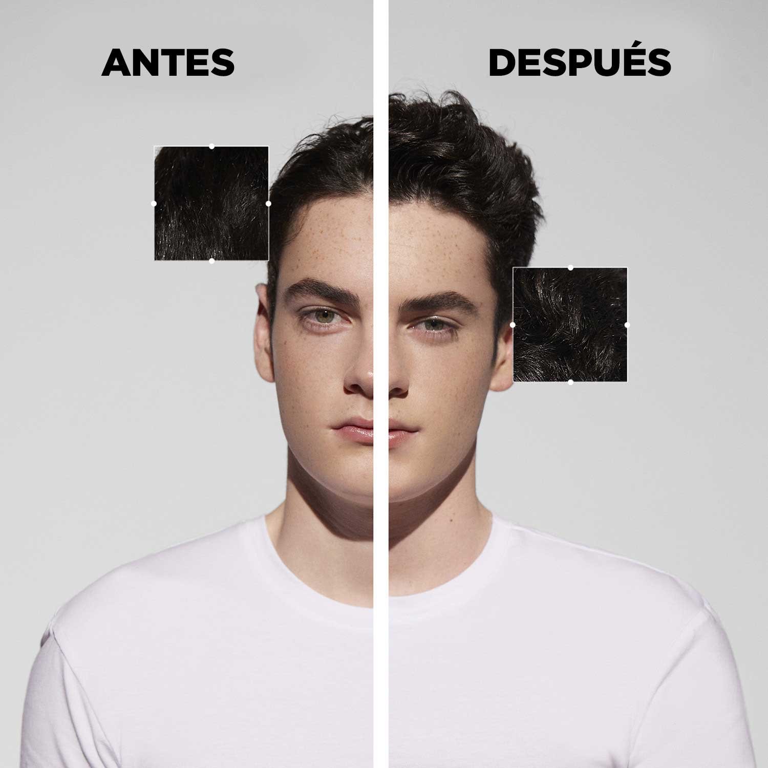 Resultados Shampoo anti-caspa Bain Anti-Pelliculaire Specifique 