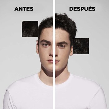 Resultados Shampoo anti-caspa Bain Anti-Pelliculaire Specifique